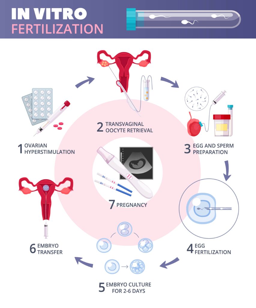 IVF Treatment Hospital in Pune
