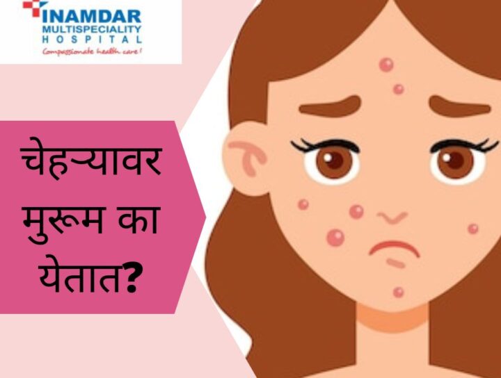 चेहऱ्यावर मुरूम का येतात? | Inamdar Hospital