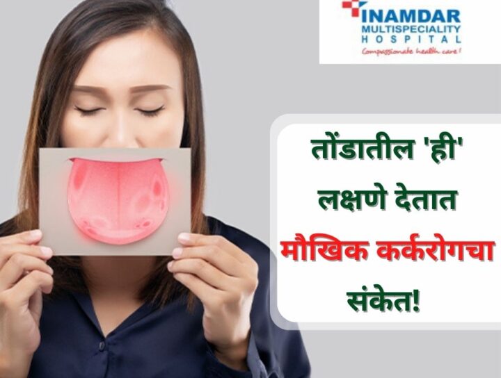 तोंडाचा कर्करोग | Inamdar Hospital