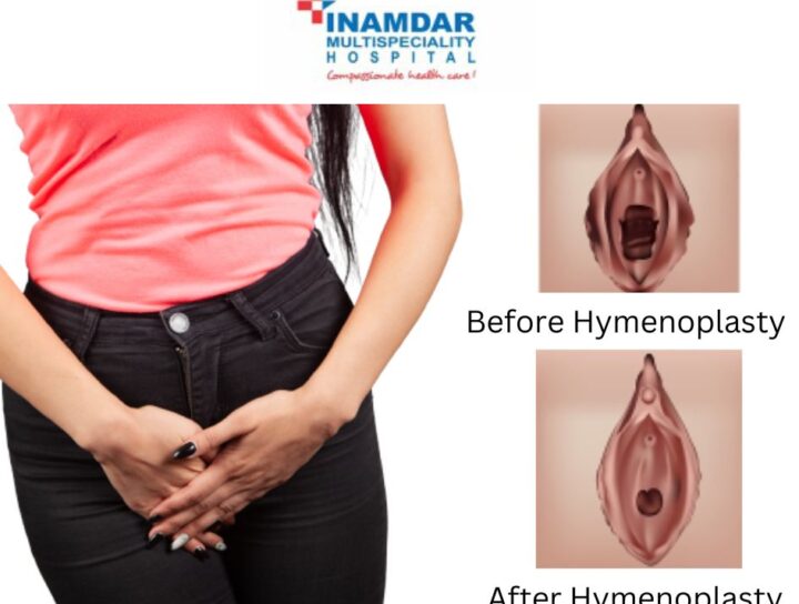 हायमेनोप्लास्टी | Hymenoplasty Treatment in Pune | Inamdar Hospital