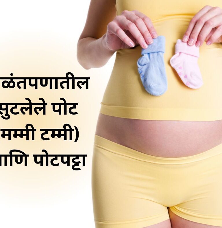 बाळंतपणातील सुटलेले पोट (मम्मी टम्मी) आणि पोटपट्टा | Inamdar Hospital