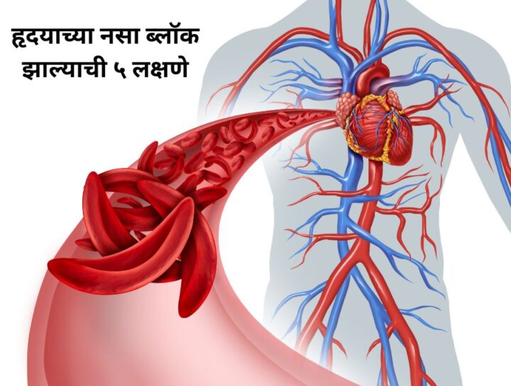 हृदयाच्या नसा ब्लॉक झाल्याची ५ लक्षणे | Inamdar Hospital