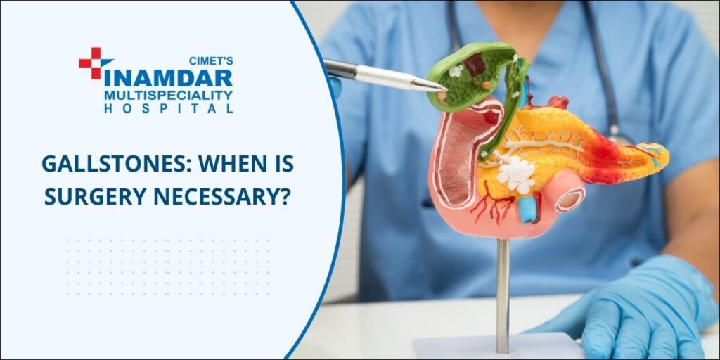 Gallstones: When Is Surgery Necessary